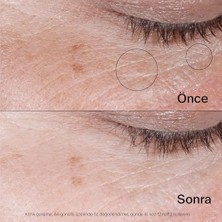 TeknoKapsül Bank Canlandırıcı Jel Göz Kremi 15 Gram