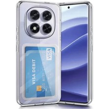 Erdo Ticaret Buğz Xiaomi Redmi Note 14 Pro 5g Kılıf Kart Şeffaf Silikon - Şeffaf