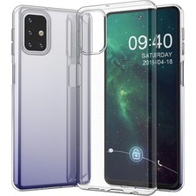 Erdo Ticaret Buğz Samsung Galaxy M31S Kılıf Lüx Şeffaf Silikon