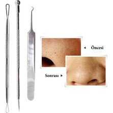 Paslanmaz Çelik Siyah Nokta Sivilce ve Akne Temizleyici Set 3'lü Kit ( Lisinya )