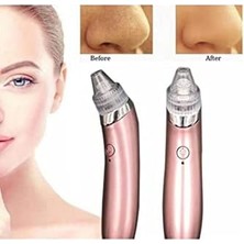 Nacario Profesyonel Vakumlu Siyah Nokta Akne Cilt Temizleme Cihazı