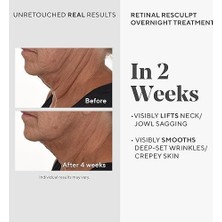 Teknocan Marketing Retinal Resculpt Overnight Treatment Retinal Içeren Yenileyici Gece Serumu, 30 ml