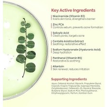 Vigordurus Akne Kremi Yüz Için – Sivilce ve Akne Karşıtı Leke Kremi – Salisilik Asit & Niasinamid ile Leke Giderici – Genç ve Yetişkin Cilt Bakımı, 40 ml