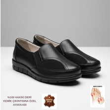 Ceyo Tam Ortopedik %100 Hakiki Deri Kemik Çıkıntısına Özel Kadın Ayakkabı