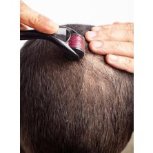 Tuba Toptaş Titanyum Uçlu Dermaroller Iğneli Sakal Saç Yenileyici Cilt Yüz Vücut Yenileme Masaj Aleti 0.50MM