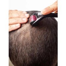 Calperia Titanyum Uçlu Saç ve Sakal Çıkarma Tarağı | Dermaroller 0,75 mm