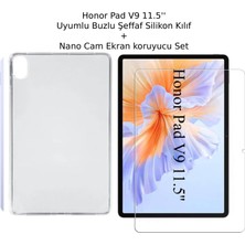 Ukscase Honor Pad V9 11.5'' Uyumlu Buzlu Şeffaf Silikon Kılıf