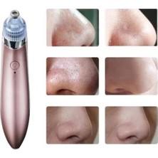 Pileli Store Pilelistore  Siyah Nokta Cihazı