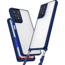 Ulugo Xiaomi Redmi Note 11 Pro Kılıf Penta Silikon Kılıf - Lacivert