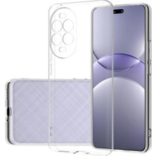 Prolysus Huawei Nova 13 Pro Kılıf Kamera Korumalı Şeffaf Yumuşak Silikon Kılıf