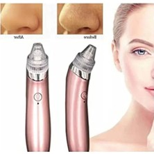 Hakay Vakumlu Siyah Nokta Temizleme Cihazı - Derinlemesine Cilt Bakımı