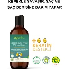 Markaon Üreticiniz Doğal Kepeğe Karşı Şampuan 400 ml YN1348