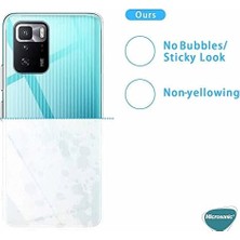 Uray Home X3 Gt Için Kılıf Transparent Soft Beyaz [ X3 Gt ile Uyumlu Kılıf - Şeffaf]