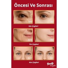 Uray Home Boyun Yüz Sıkılaştırıcı Kırışıklık Giderme Aleti, Çift Çene Azaltıcı Titreşim Masajı Kırışıklıklar Görünüm Giderme ve Yüz Için Cilt Sıkılaştırma, Boyun