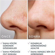 Emdeco Gözenek Minimizing Toner Pedleri 60 Adet – Witch Hazel & Centella Asiatica Peeling Yüz Pedleri, Yağ, Akne Taç Cilt Için – Gözenek Minimizer ve Redness Rölyef