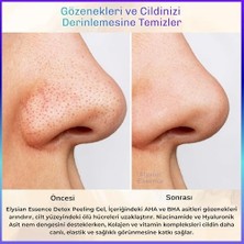 Ecovibe Detox Peeling Jel 125 ml | Ölü Hücre Arındırıcı Temizleme Jeli | Yüz ve Vücut Temizleyici | Aha Bha, Vitamin C,