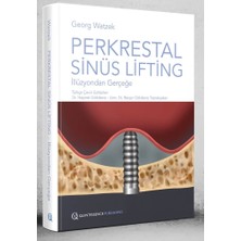 Perkrestal Sinüs Lifting – Illüzyondan Gerçeğe