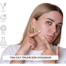 Leke Kremi ve Cilt Beyazlatıcı Krem 40ML
