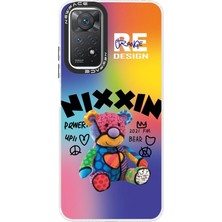 Senson Xiaomi Redmi Note 11 Pro Kılıf Estoril Desenli Kapak - Estoril - 11