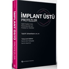 Quintessence Publishing Implant Üstü Protezler - Sabit Implant Üstü Restorasyonlar Için Protokol ve Teknikler