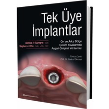 Quintessence Publishing Tek Üye Implantlar - Ön ve Arka Bölge Çekim Yuvalarında Asgari Girişimli Yöntemler