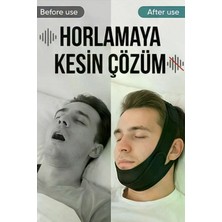 Figiza Ayarlanabilir Çene Destekli Horlama Önleyici Yüz Bandı Gıdı Toparlayıcı Uyku Maskesi (Kadın-Erkek)