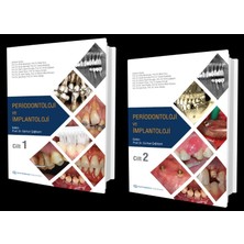 Quintessence Publishing Periodontoloji ve Implantoloji (Cilt 1 ve 2) Prof. Dr. Gürhan Çağlayan