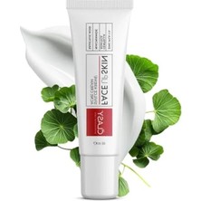 Ulu Pazarlama 40 ml Akne Kremi - Salisilik Asit ve Niasinamid ile Leke Giderici