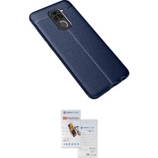 Toyigoo Ieg™ Redmi Note 9 Kılıf Doruk Klasik Özel Seri - Siyah Seramik Nano Ekran Koruyucu