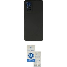 Toyigoo Ieg™ Redmi Note 11 Kılıf Kozmos Yansıma Özel Seri - Şeffaf Royal Nano Ekran Koruyucu