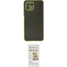 Toyigoo Ieg™ Mi 11 Lite Kılıf Ahenk Çizgi Serisi - Siyah Mat Seramik Nano Ekran Koruyucu