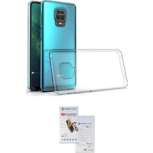 Toyigoo Ieg™ Redmi Note 9 Pro Kılıf Zirve Doku - Siyah Seramik Nano Ekran Koruyucu