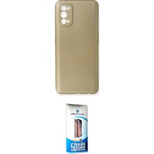 Toyigoo Ieg™ 7 Pro Kılıf Kozmos Yansıma Özel Seri - Siyah 5d Eko Cam Ekran Koruyucu