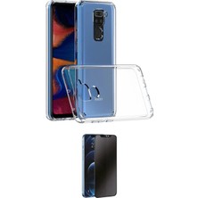 Toyigoo Ieg™ Redmi Note 9 Kılıf Zirve Doku - Siyah 3D Antistatik Hayalet Cam Ekran Koruyucu