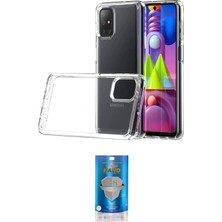 Toyigoo Ieg™ Galaxy M51 Kılıf Zirve Doku - Şeffaf Royal Nano Ekran Koruyucu