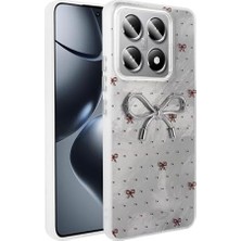 Daisy Home 14T Pro ile Uyumlu Kılıf Kamera Korumalı Fiyonk Kalp Figürlü Ponti Kapak Açık Mavi