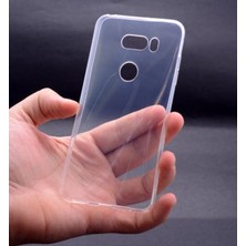 Royal Cover Lg V30 Kılıf Esnek ve Şeffaf Premium Tpu Silikon Kapak Rcv / Ss