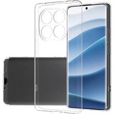 Kvy Xiaomi Redmi Note 15 4G Kamera Korumalı Süper Silikon Kılıf