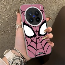 Ucuc Vivo X200 Pro Uyumlu Sert Akrilik Arka Silikon Kenar Lens Koruma Şık Baskı Kılıf