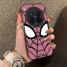 Ucuc Vivo X300 Pro Uyumlu Sert Akrilik Arka Silikon Kenar Lens Koruma Şık Baskı Kılıf