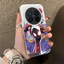 Ucuc Vivo X200 Pro Uyumlu Sert Akrilik Arka Silikon Kenar Lens Koruma Şık Baskı Kılıf
