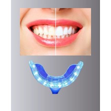 Shekip Jewellery Beyazlatma Kalemli LED Diş Parlatma Seti