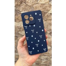 Vip Case Omix X7 Uyumlu Mini Fiyonk Desenli Silikon Darbe Emici Klasik Korumalı Rubber Kılıf 277