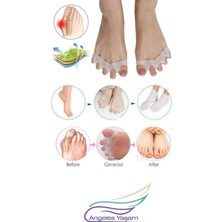 Angeles Yaşam Silikon Bunyon Parmak Düzenleyici 5 Parmak Geçmeli Bunyon Koruyucu