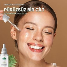 Naque Akne Karşıtı Serum 30 ml