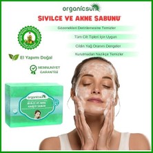 Esmo Home 2'li Set Doğal Kükürt Sabunu ve Sivilce ve Akne Karşıtı Sabun Sivilce Karşıtı Sabun Seti