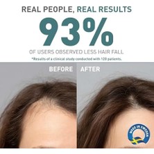 Esmo Home Bionnex Organıca Saç Dökülmesi Karşıtı Şampuan- Yağlı Saçlar Için 300 ml