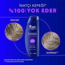Esmo Home & Shoulders Clinical Strength Advanced Oil Control Yağ Dengeleyici Şampuan 400 ml