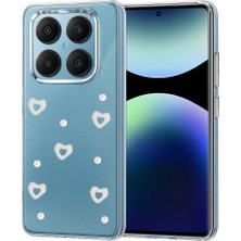 Selfbuysell Xiaomi Redmi Note 14 Pro 4g Fiyonk Desenli Kapak - Desen 10