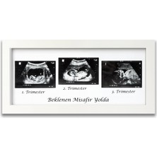 PremiumPort Bebek Ultrason Fotoğraf Çerçevesi 3'lü, Hamilelik Anı Dekorasyonu
